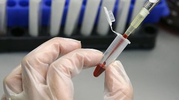 У Львові будуть безоплатно забезпечувати ліками хворих на множинну мієлому