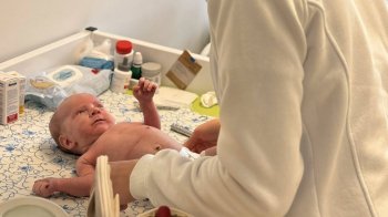 У Львові лікарі врятували немовля з високою кишковою непрохідністю