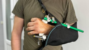 На Львівщині лікарі врятували руку чоловіку, яку він відрізав бензопилою