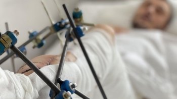 У Першому ТМО Львова за п'ять місяців війни пролікували понад 4300 пацієнтів з травмами від обстрілів