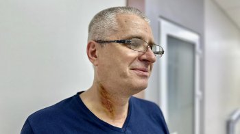 Львівські хірурги видалили рідкісну пухлину на шиї 54-річного чоловіка