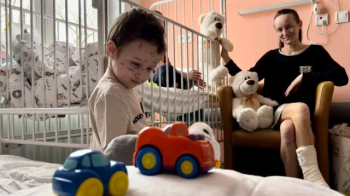 Польські медики врятували зір мамі та її двом синам: вони постраждали через вибух міни на Луганщині