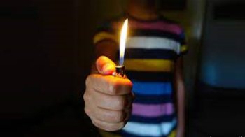 Заснув біля пічки та загорівся: на Львівщині чоловік з недбалості отримав опіки спини та рук