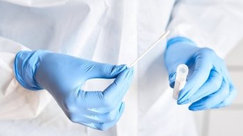 Хто має право на безкоштовний тест Covid-19