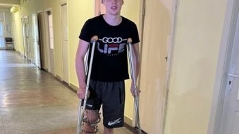 Львівські лікарі врятували ногу 17-річному волонтеру
