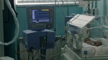 Львівські лікарі діагностували у немовляти рідкісну ваду розвитку