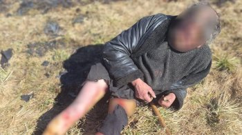 У Львові внаслідок важких травм через підпал трави за один день померли троє людей