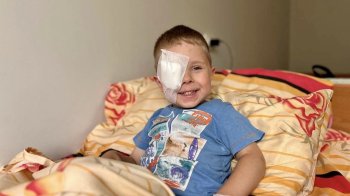 Собака вкусив 4-річного хлопчика в око: львівські хірурги врятували зір дитини