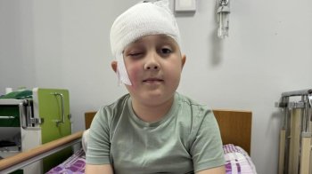У Львові 8-річному хлопчику видалили складну пухлину, яка впливала на зір