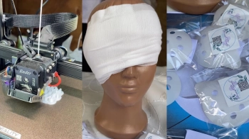 Студенти з Новояворівська розробили накладки для очей, які допоможуть зберегти зір військовим при пораненні