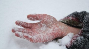 На Самбірщині 46-річна жінка потрапила в реанімацію через переохолодження