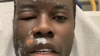 Росіяни побили темношкірого блогера з України