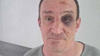 На Львівщині у Городку військовий жорстоко побив ветерана, який був у полоні