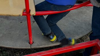 На Дрогобиччині рятувальники допомогли 5-річному хлопчику дістати ногу з каруселі