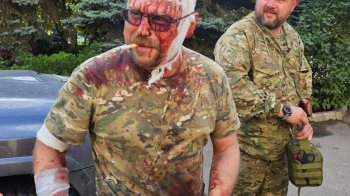 Під Бахмутом поранили колишнього ватажка так званої «ДНР»