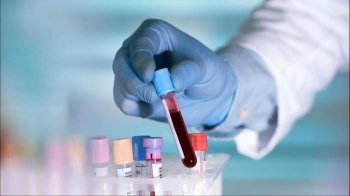 Коронавірус: 29 липня, актуальна статистика