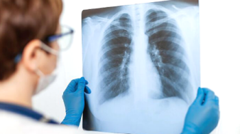 Львів’яни можуть зробити рентген-обстеження вдома