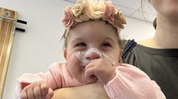 Рідкісний випадок: у Львові лікують немовля із двома унікальними патологіями