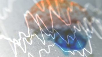 Результати енцефалограми