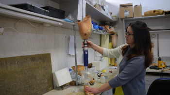 На Львівщині двом жінкам, які під час війни втратили ноги, встановили протези