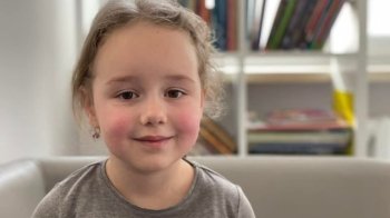 Львівські медики прооперували дівчинку яка народилась із шістьма пальцями на руці