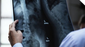 Відомий американський хірург лікуватиме у Львові дітей з вадами хребта