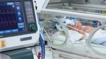 Львівські лікарі врятували піврічне немовля за допомогою «штучних легень» для дорослих