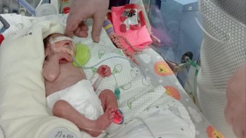 Крихітка вагою 600 грамів