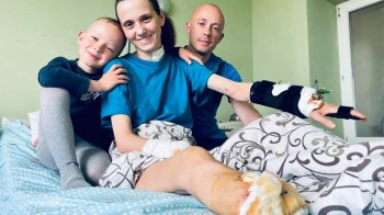 Через російську ракету втратила руку, ногу та дитину під серцем: у Львові лікували тяжко поранену переселенку 