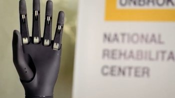 У Львові встановили перший біонічний протез військовому (відео)