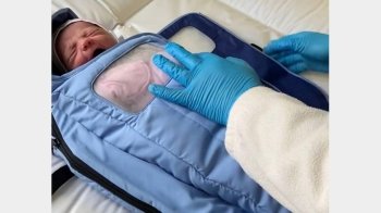 Грілки для поспішайок: у пологовому Львова передчасно народженим дітям стане тепліше