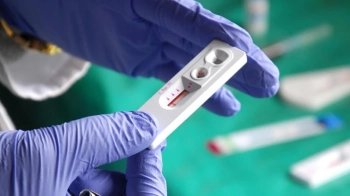 Львів'ян запрошують пройти безоплатне тестування на ВІЛ-інфекцію