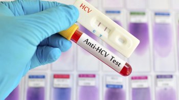 Факти про гепатит, які можуть врятувати життя