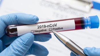 Коронавірус на Львівщині: у медзаклади госпіталізували понад 50 пацієнтів