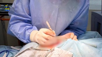 У Львові медики врятували немовля, яке народилося із органами назовні