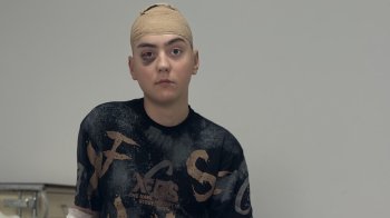 У Львові лікарі видалили 17-річному підлітку рідкісну пухлину в мозку