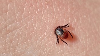 Після укусу кліща у 53-річної мешканки Львівщини підтвердили кліщовий енцефаліт