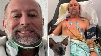 Перечепився через кота: чоловік пролетів з другого поверху на перший, зламав хребет та вижив