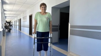 У Львові врятували жінку зі складною патологією суглобів обидвох ніг