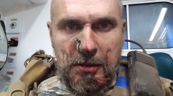 Тільки відновився після контузії: Олег Сенцов потрапив під артилерійський обстріл
