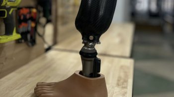 В Університетській лікарні Львова запрацювала найбільша в Європі протезна майстерня