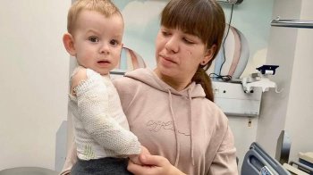 Львівські медики врятували немовля від важких опіків