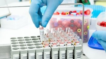 Чому штам Дельта такий небезпечний — пояснення епідеміологині