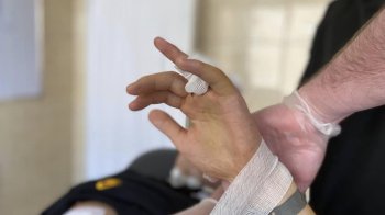 Щоб врятувати палець використали частину ребра: у Львові лікували 24-річного чоловіка із пухлиною кістки