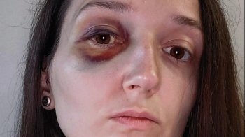 Поліція знайшла підлітка, який побив пасажирку у львівському трамваї