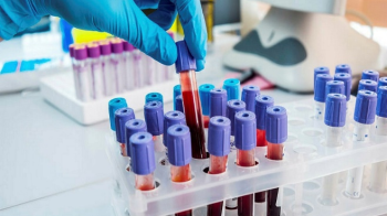 Укрзалізниця закликала приватні лабораторії не передавати поїздами кров для аналізів