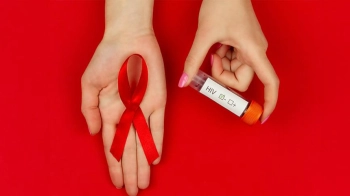 У Львові у День закоханих у Шевченківському гаю безкоштовно обстежуватимуть на ВІЛ