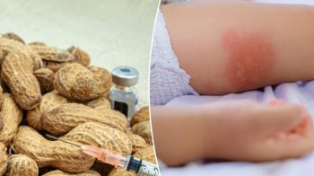 Немовлят можна годувати арахісовою пастою, щоб уникнути смертельної алергії: деталі