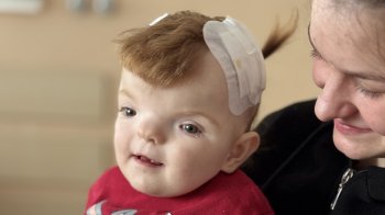 Львівські лікарі провели унікальну операцію маленькій дівчинці