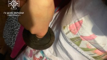 У Львові палець дитини застряг у кільці від гирі, довелось викликати рятувальників (фото)